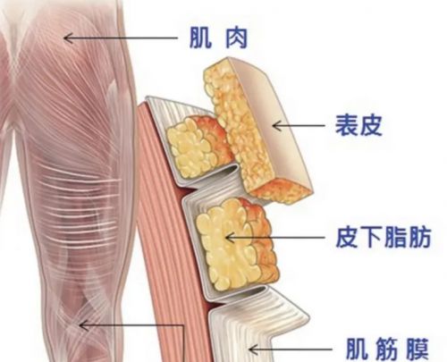 筋膜枪精品排行榜新鲜出炉，深度解析热门品牌选购指南